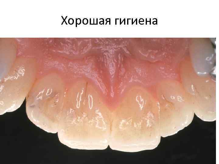 Хорошая гигиена 