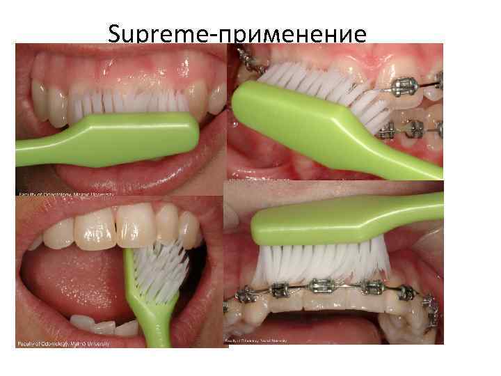 Supreme-применение 