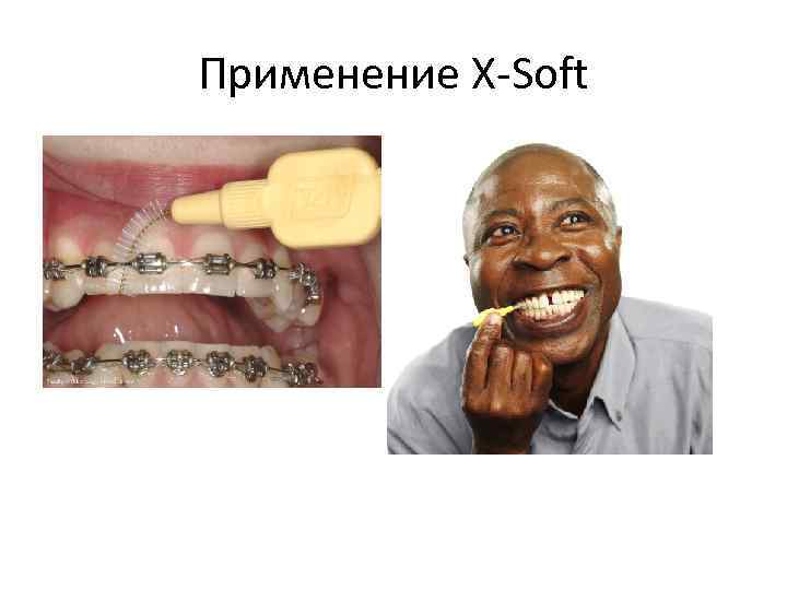 Применение X-Soft 