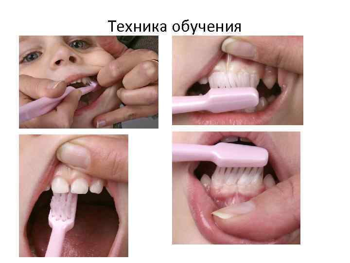 Техника обучения 