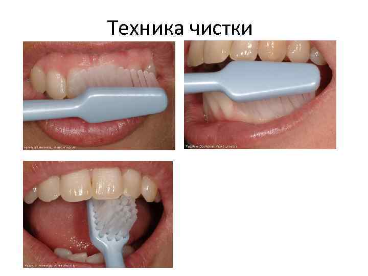 Техника чистки 