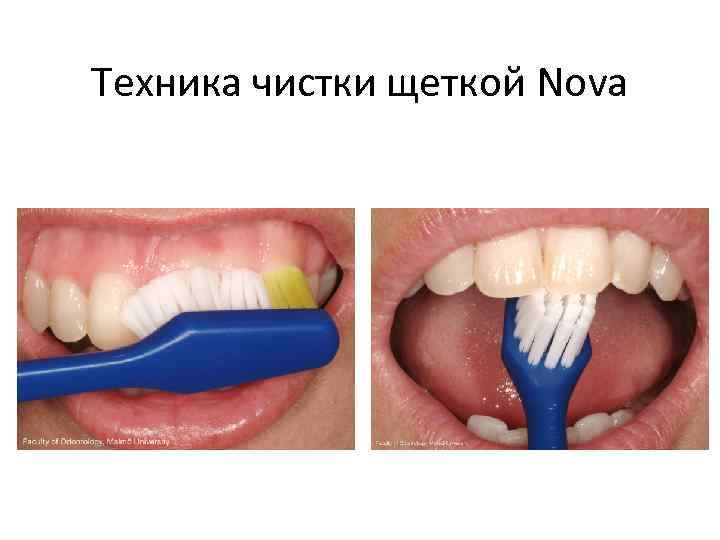 Техника чистки щеткой Nova 