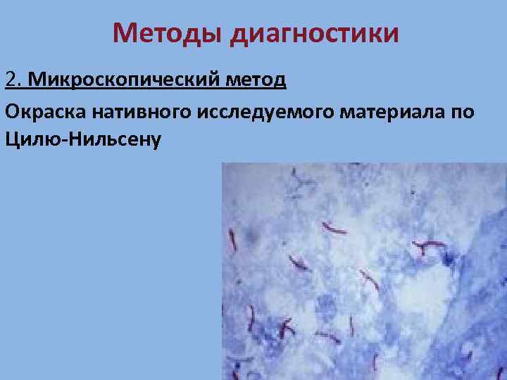 Методы диагностики 2. Микроскопический метод Окраска нативного исследуемого материала по Цилю-Нильсену 