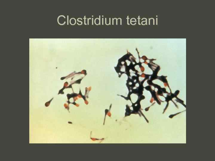 Clostridium tetani 