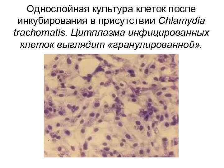 Однослойная культура клеток после инкубирования в присутствии Chlamydia trachomatis. Цитплазма инфицированных клеток выглядит «гранулированной»