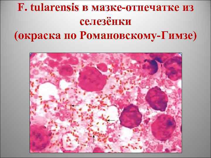 F. tularensis в мазке-отпечатке из селезёнки (окраска по Романовскому-Гимзе) 