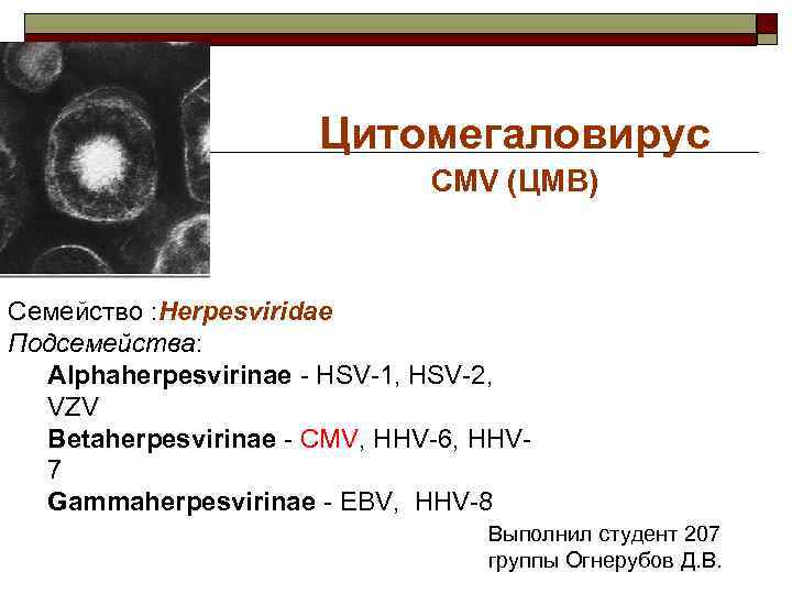 Цитомегаловирус CMV (ЦМВ) Семейство : Herpesviridae Подсемейства: Alphaherpesvirinae - HSV-1, HSV-2, VZV Betaherpesvirinae -