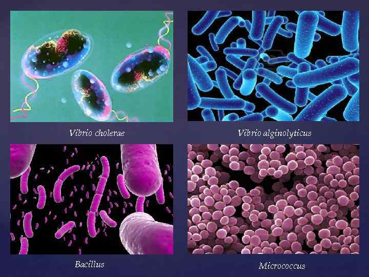 Vibrio cholerae Bacillus Vibrio alginolyticus Micrococcus 