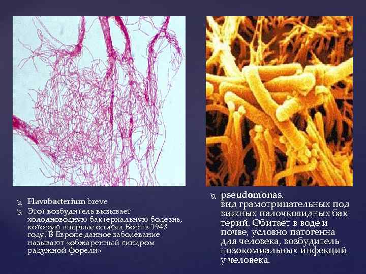  Flavobacterium breve Этот возбудитель вызывает холодноводную бактериальную болезнь, которую впервые описал Борг в