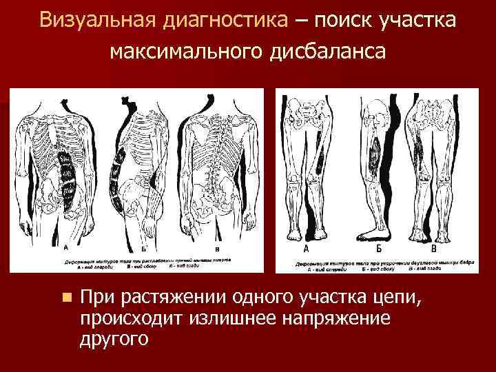 Визуальная диагностика – поиск участка максимального дисбаланса n При растяжении одного участка цепи, происходит