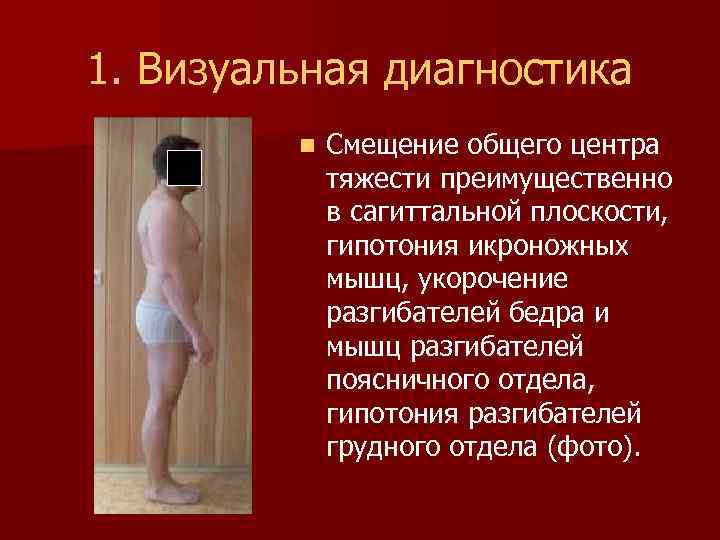 1. Визуальная диагностика n Смещение общего центра тяжести преимущественно в сагиттальной плоскости, гипотония икроножных