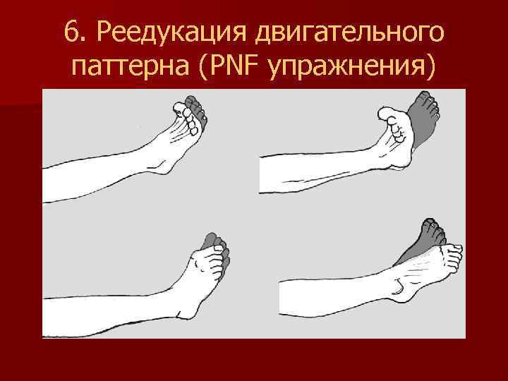 6. Реедукация двигательного паттерна (PNF упражнения) 