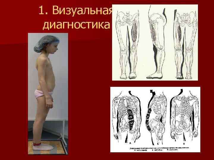 1. Визуальная диагностика 