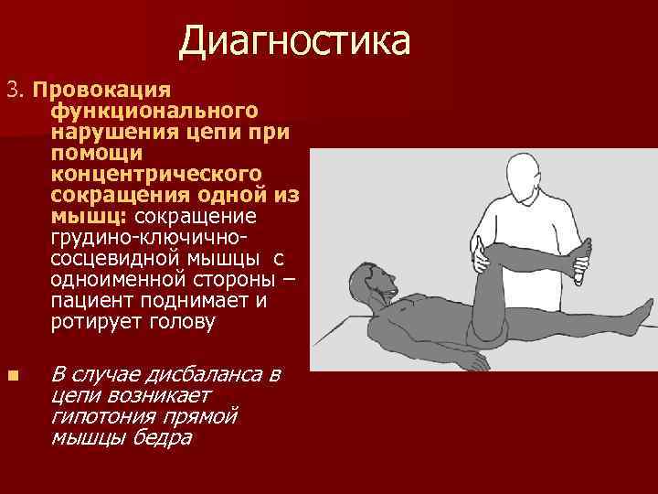 Диагностика 3. Провокация функционального нарушения цепи при помощи концентрического сокращения одной из мышц: сокращение