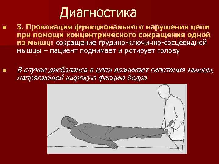 Диагностика n 3. Провокация функционального нарушения цепи при помощи концентрического сокращения одной из мышц: