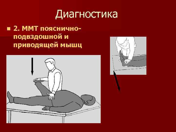 Диагностика n 2. ММТ поясничноподвздошной и приводящей мышц 