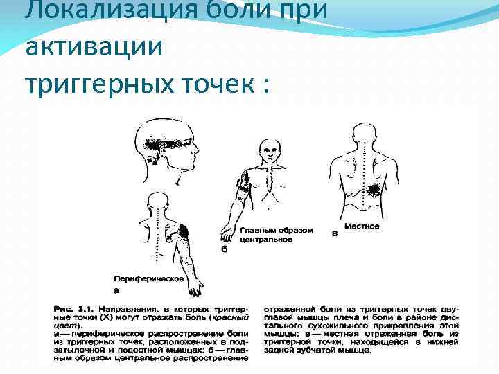 Локализация боли