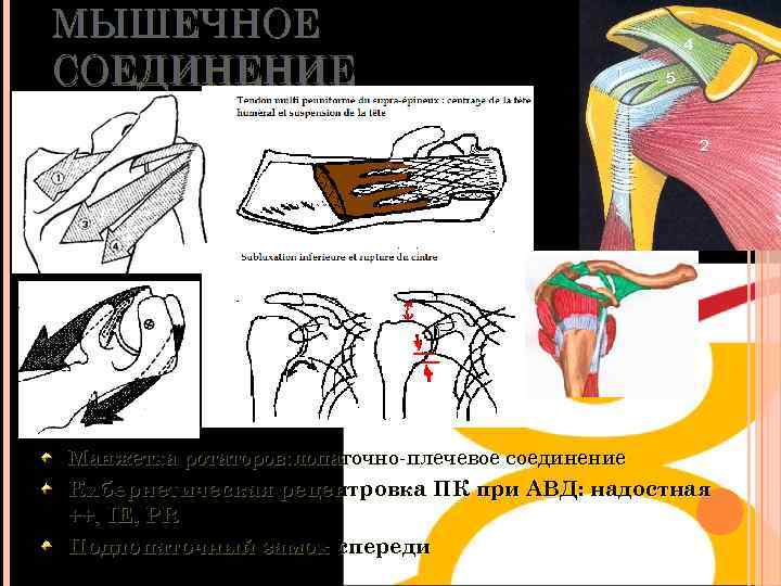 МЫШЕЧНОЕ СОЕДИНЕНИЕ Манжетка ротаторов: лопаточно-плечевое соединение Кибернетическая рецентровка ПК при АВД: надостная ++, IE,