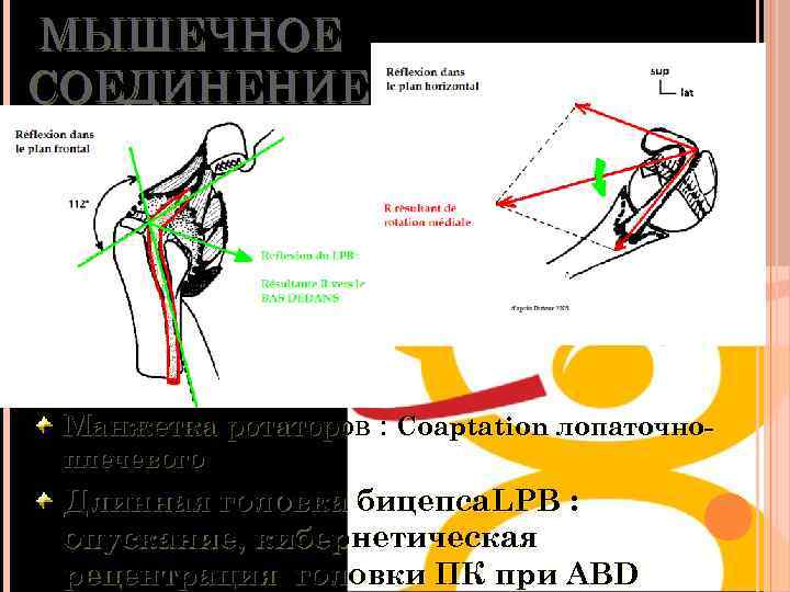 МЫШЕЧНОЕ СОЕДИНЕНИЕ Манжетка ротаторов : Coaptation лопаточноплечевого Длинная головка бицепса. LPB : опускание, кибернетическая