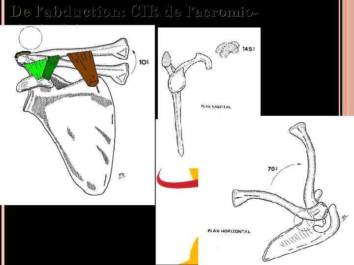 De l’abduction: CIR de l’acromioclaviculaire 