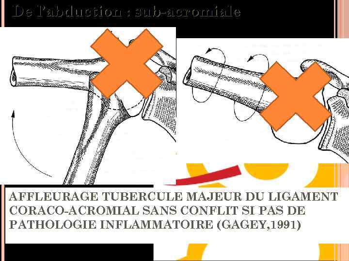 De l’abduction : sub-acromiale Théorique : AFFLEURAGE TUBERCULE MAJEUR DU LIGAMENT effet butée trochiter