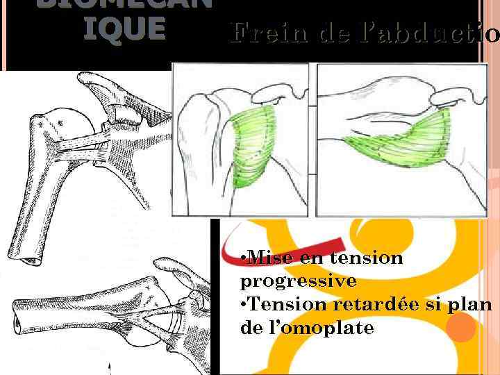 BIOMÉCAN IQUE Frein de l’abductio • Mise en tension progressive • Tension retardée si