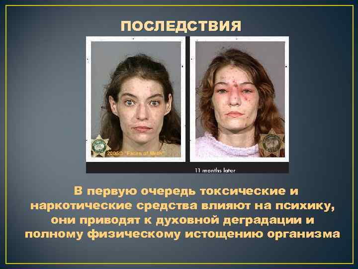 ПОСЛЕДСТВИЯ В первую очередь токсические и наркотические средства влияют на психику, они приводят к