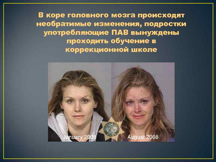 В коре головного мозга происходят необратимые изменения, подростки употребляющие ПАВ вынуждены проходить обучение в