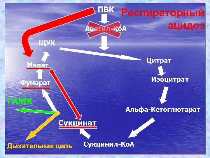 Респираторный ацидоз 