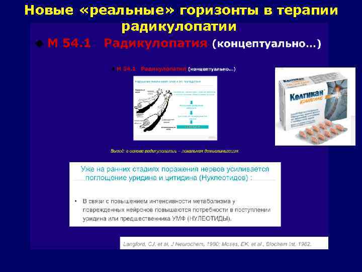 Новые «реальные» горизонты в терапии радикулопатии 