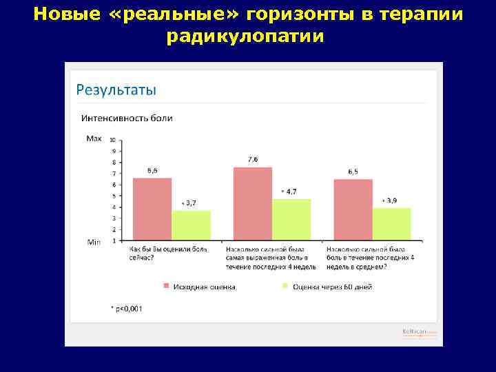 Новые «реальные» горизонты в терапии радикулопатии 