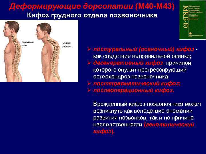 Диагноз грудного отдела позвоночника