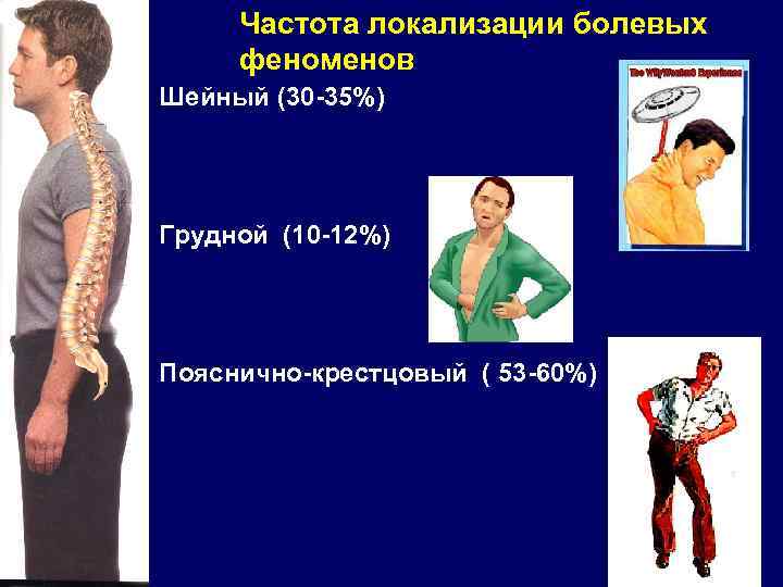 Частота локализации болевых феноменов Шейный (30 -35%) Грудной (10 -12%) Пояснично-крестцовый ( 53 -60%)