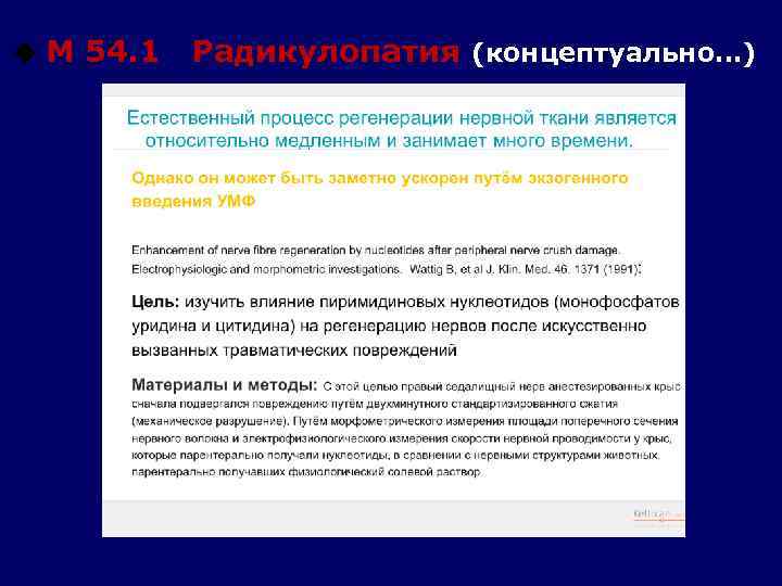 u М 54. 1 Радикулопатия (концептуально…) 
