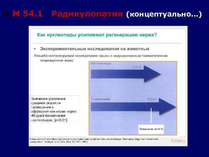 u М 54. 1 Радикулопатия (концептуально…) 