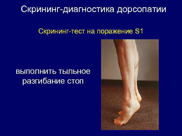 Скрининг-диагностика дорсопатии Скрининг-тест на поражение S 1 выполнить тыльное разгибание стоп 
