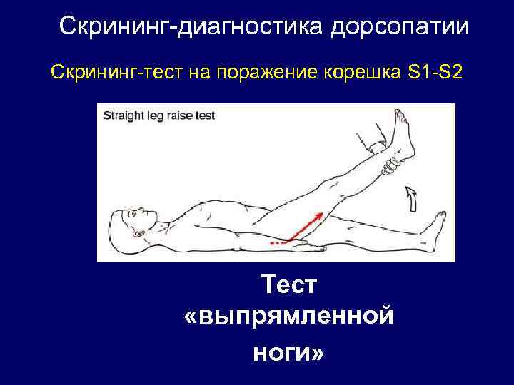 Скрининг-диагностика дорсопатии Скрининг-тест на поражение корешка S 1 -S 2 Тест «выпрямленной ноги» 