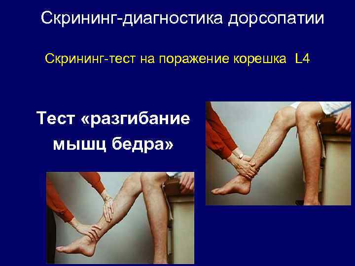 Скрининг-диагностика дорсопатии Скрининг-тест на поражение корешка L 4 Тест «разгибание мышц бедра» 