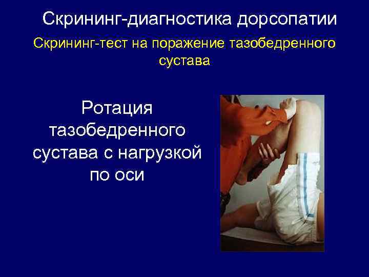 Скрининг-диагностика дорсопатии Скрининг-тест на поражение тазобедренного сустава Ротация тазобедренного сустава с нагрузкой по оси