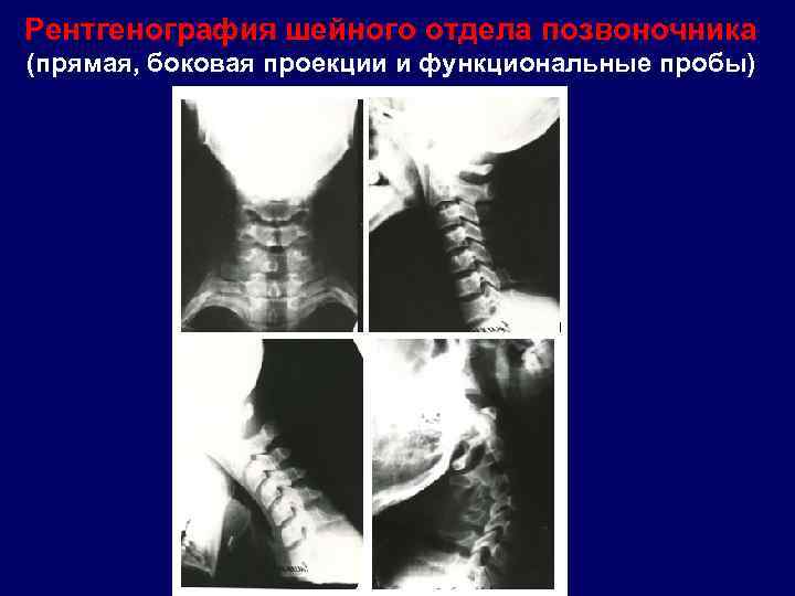 Функциональный рентген