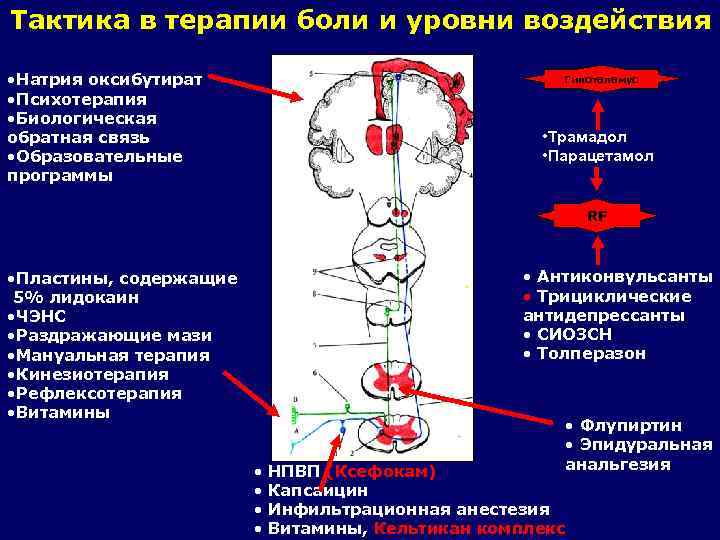 Тактика в терапии боли и уровни воздействия • Натрия оксибутират • Психотерапия • Биологическая