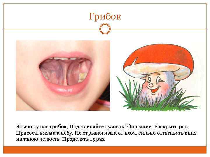 Грибок Язычок у нас грибок, Подставляйте кузовок! Описание: Раскрыть рот. Присосать язык к небу.