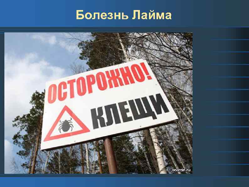 Болезнь Лайма 