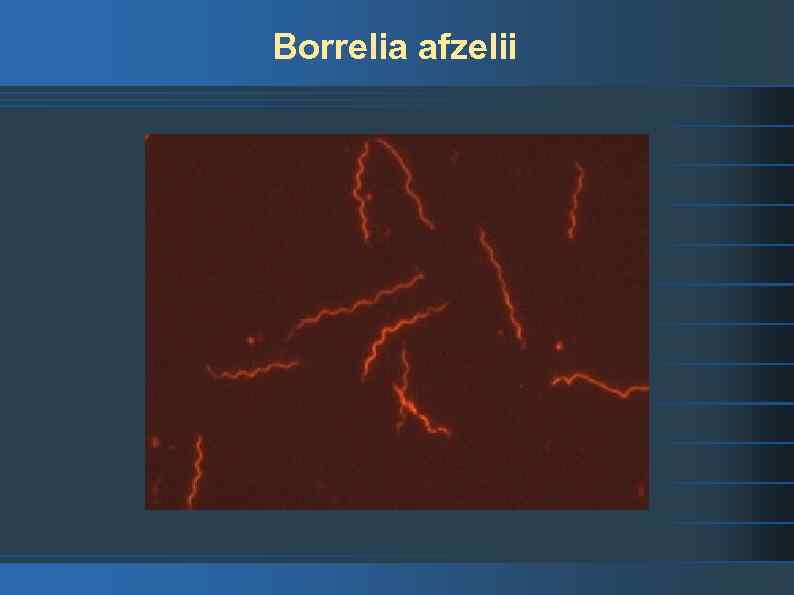 Borrelia afzelii 