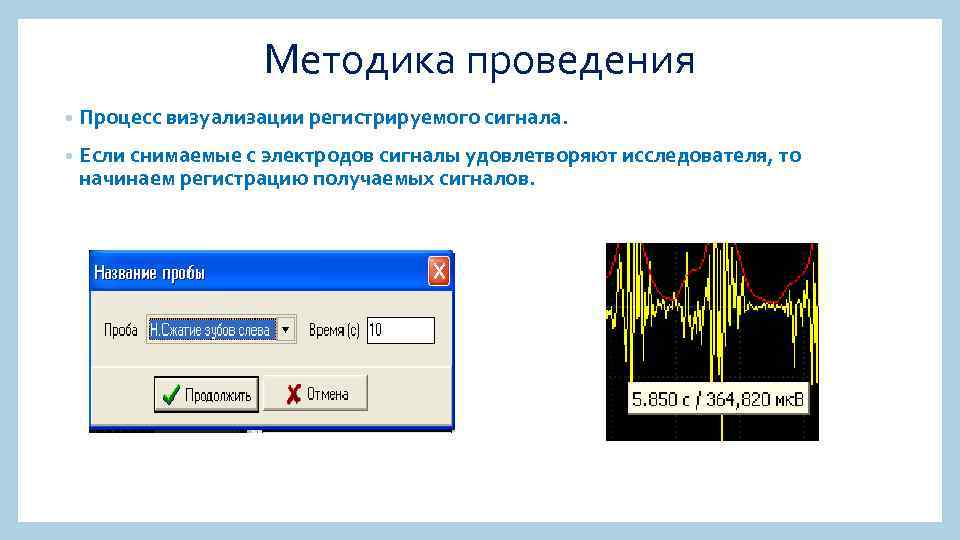Методика проведения • Процесс визуализации регистрируемого сигнала. • Если снимаемые с электродов сигналы удовлетворяют