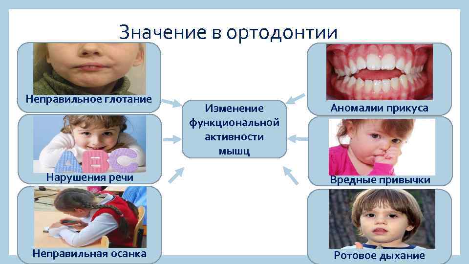 Значение в ортодонтии Неправильное глотание Изменение функциональной активности мышц Аномалии прикуса Нарушения речи Вредные