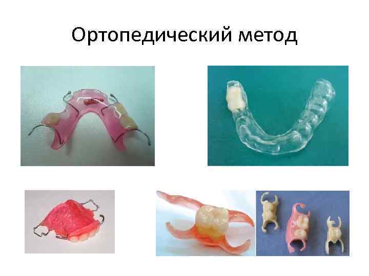 Ортопедический метод 