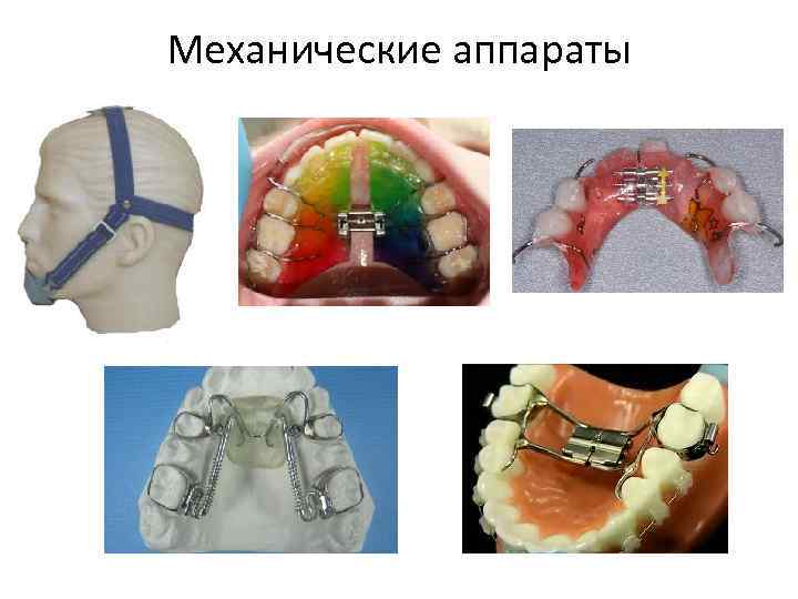 Механические аппараты 