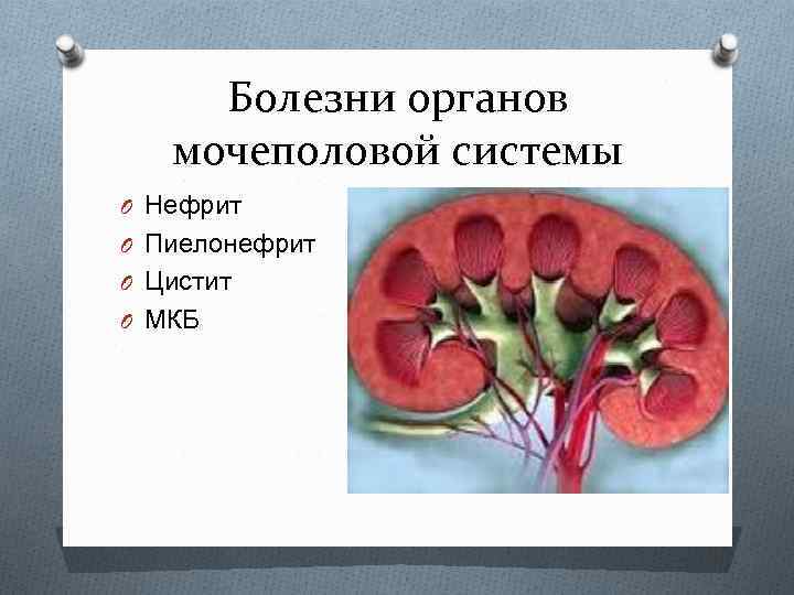 Болезни органов мочеполовой системы O Нефрит O Пиелонефрит O Цистит O МКБ 