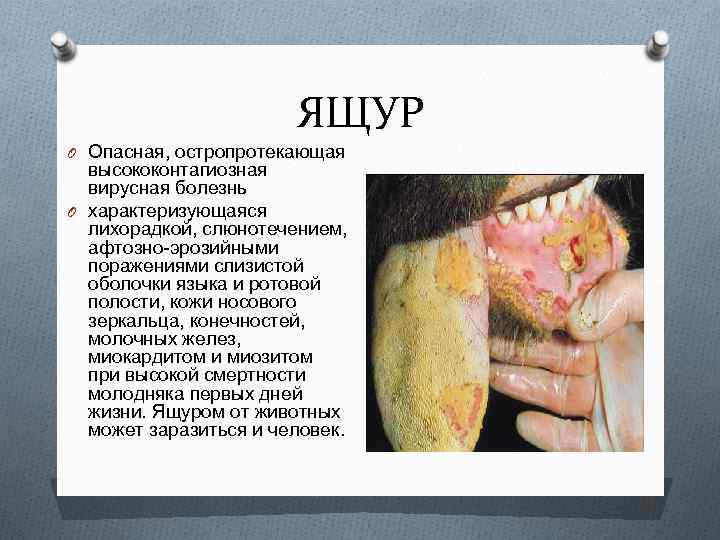 ЯЩУР O Опасная, остропротекающая высококонтагиозная вирусная болезнь O характеризующаяся лихорадкой, слюнотечением, афтозно эрозийными поражениями